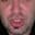 OrvilRectumBlocker